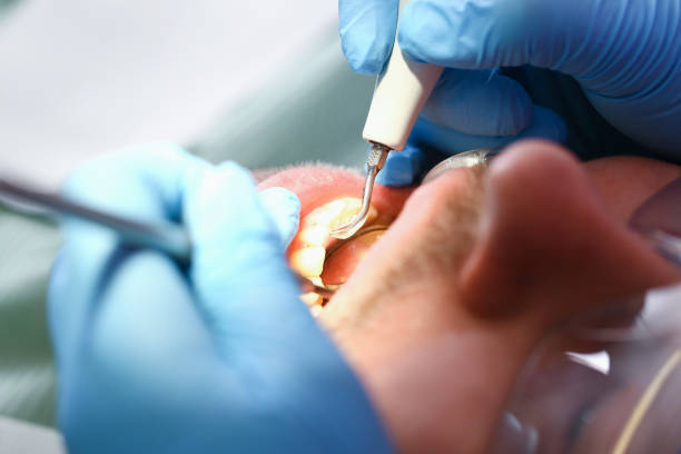 Best 24-Hour Emergency Dental Care in George Mason, VA