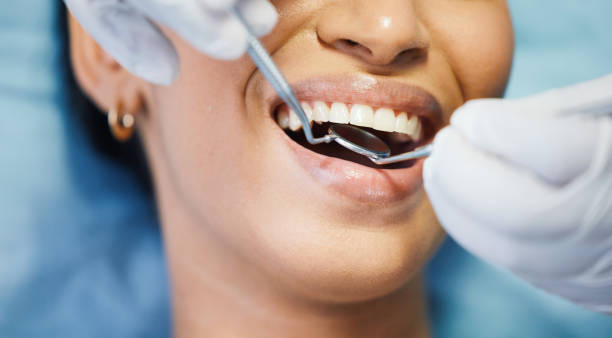 Best Broken or Chipped Tooth Repair in George Mason, VA